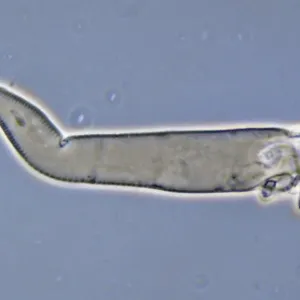 Demodex uncii, follicle mite