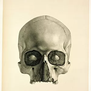 Engraving of a human skull