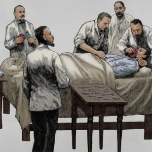 History of medicine. Chloroform anesthesia. Engraving, 19th