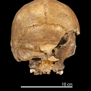 Homo heildelbergensis, Broken Hill Man