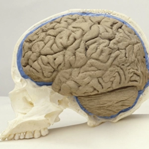 Homo sapiens, Human cranium with brain