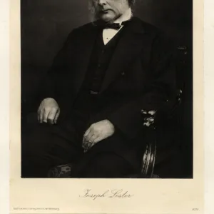 Joseph Lister, 1st Baron Lister