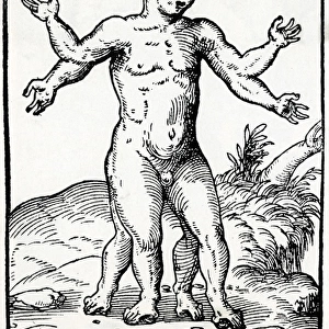 Multi-Limbed Child / 1560