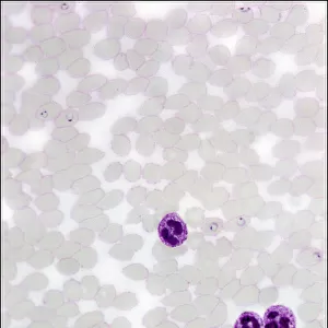 Plasmodium sp. malarial parasite