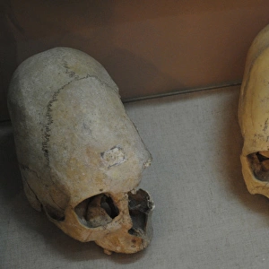 Sarmatians. Deformed human skulls. Probably dated in the 3rd