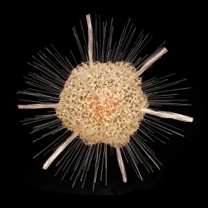 Spongosphaera streptacantha, radiolarian