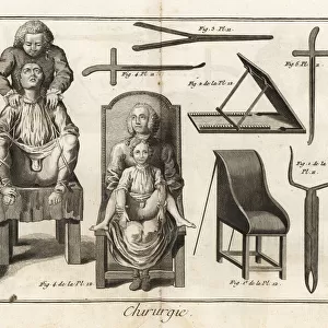 Surgical chairs and instruments for a bladder