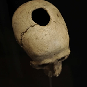 Trepanned skull. Neolithic Period. Denmark