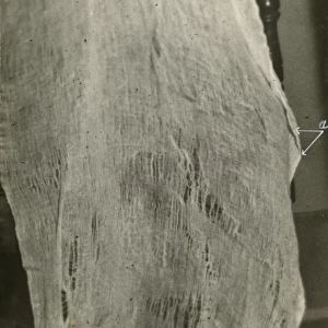 Undated photograph of enlarged portion of ectoplasm