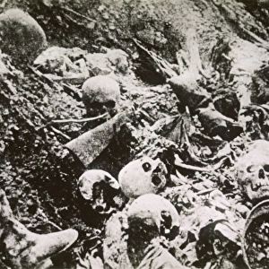 Ww1 / 1919 / Trench Skeleton
