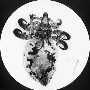 X-Ray - Antelope Parasite