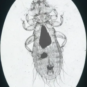 X-Ray - Microscopic x-ray view of a small head louse