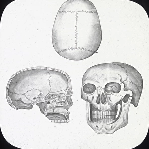 X-Ray - Skull, Front, Top-and Section