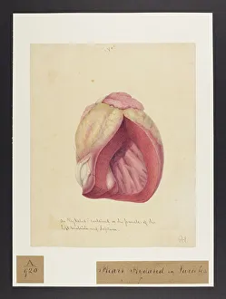 13741415