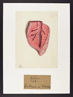 13741561