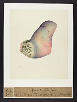 13741573