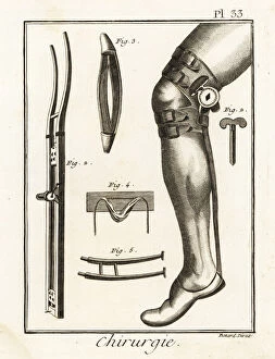 Anatomical Collection: 18th century surgical knee pad and dislocation machine