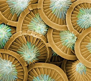 Algal Gallery: Acanthoica acanthifera