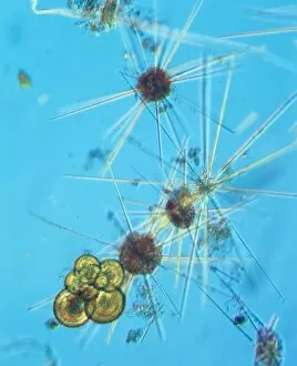 Planktonic Collection: Acanthowetra