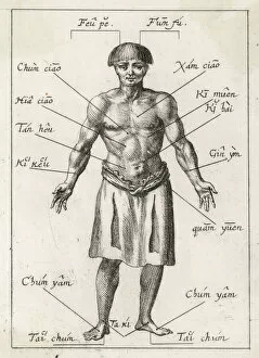 Accounts Collection: Acupuncture in 17th Cent