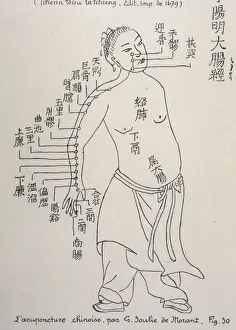 1679 Prints: Acupuncture