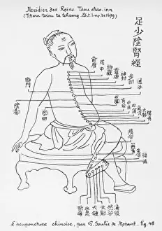 Acupuncture