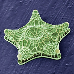 Algal Gallery: Amphitetras, diatom
