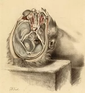 Orbit Gallery: Anatomy / Base of Skull