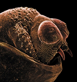 Anus Collection: The anus of a bot fly