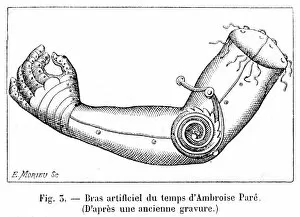 Ambroise Gallery: Artificial arm by Ambroise Par