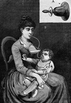 Device Gallery: Artificial Breastfeeding
