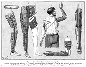 Amputation Gallery: Artificial leg and arm