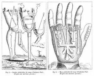 Amputation Gallery: Artificial Limbs, France 16th Century