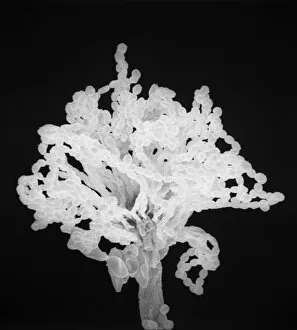 Scanning Electron Microscope Collection: Aspergillus