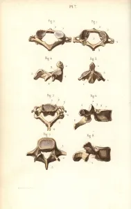 Masse Prints: Axis and vertebrae