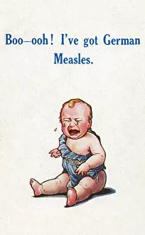 Ailment Gallery: Baby with German Measles - WWI connection