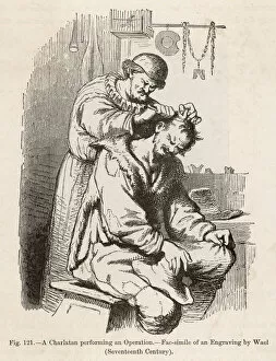 Doctors Collection: Barber-Surgeon Operation