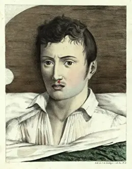 Diseases Prints: In bed with yellow fever