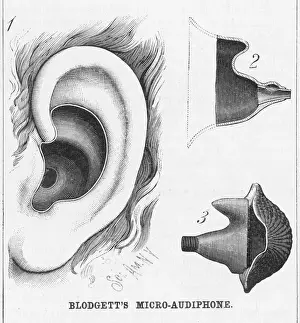 1886 Prints: Blodgetts Hearing Aid