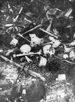 Ancre Gallery: Bones 1916