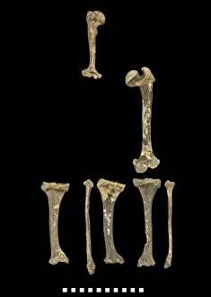 Mersekha Collection: Bones of Achondroplastic Dwarf