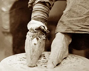Bound feet, Chine, early 1900s