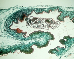 Larvae Collection: Chiggers, larvae of trombiculid mites
