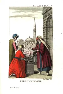 Circumcision ceremony performed by a Turkish Circumcision ceremony performed by a Turkish