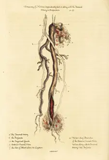 Wounds Prints: Claude Pouteau's doctrine of tying nerves to arteries in amputat