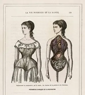 Corsets Prints: What Corsets Do