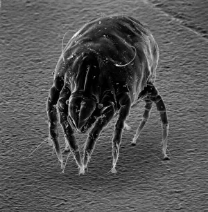 Microscope Image Gallery: Dermatophagoides sp. dust mite