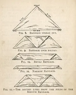 B Road Prints: Diagram showing five stages in bandage folding