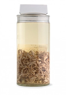 Killer Gallery: Diphyllobothrium polyrugosum, tapeworm