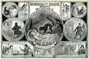 Visions Collection: Diseases of the Brain